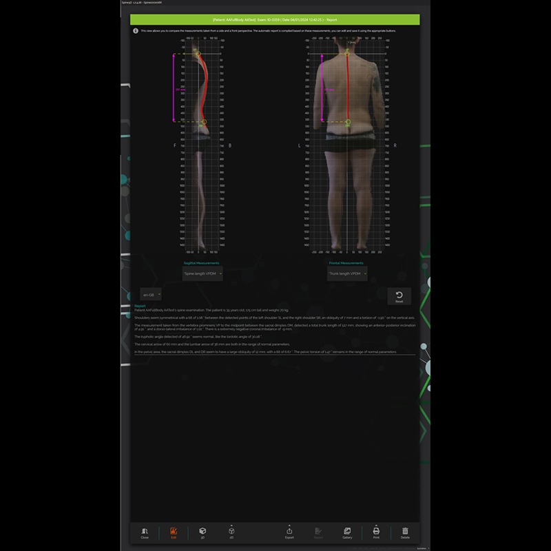 Система трёхмерного сканирования позвоночника Spine3D